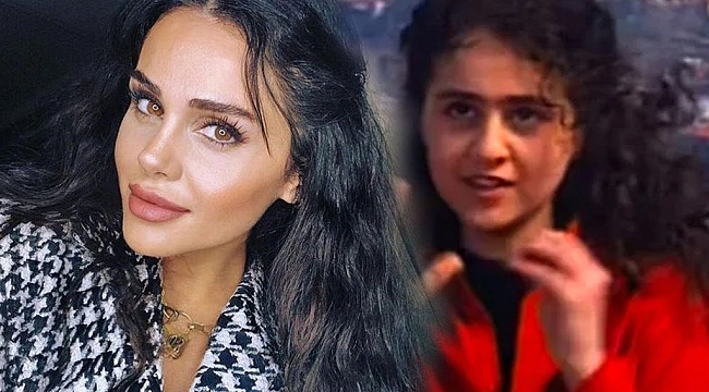 Günel Zeynalova estetiği abarttı! 'Ufak tefek işler'