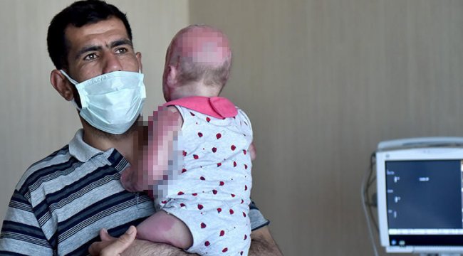 21 aylık Delal bebek mucizesi! 6 ekip kuruldu, defalarca hayata tutundu