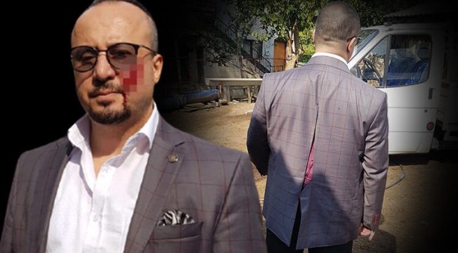 Avukat neye uğradığını şaşırdı! İşte yanağını ısıran sanığın cezası