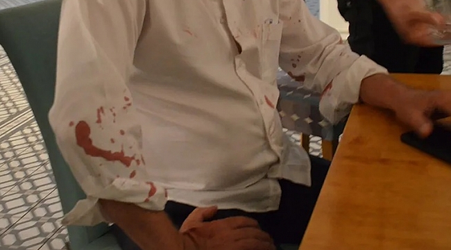 Belediye başkanına beyzbol sopalı saldırı