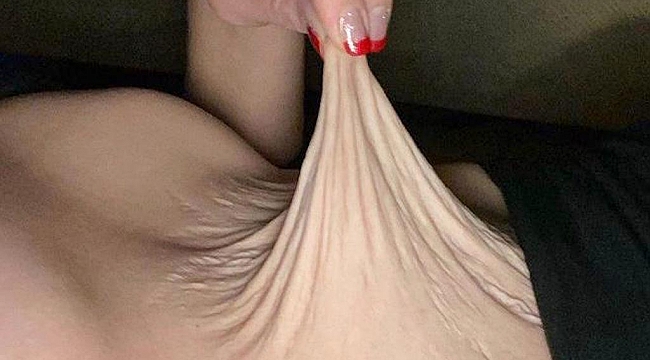 Doğum sonrası karnının görüntüsü şaşkına çevirdi: Pizza hamuru gibiydi!