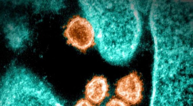 COVID-19'a Karşı İlaç Tedavisi Umudu Güçleniyor