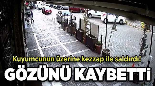 İzmir'de korkunç olay! Kuyumcuya kezzaplı saldırı