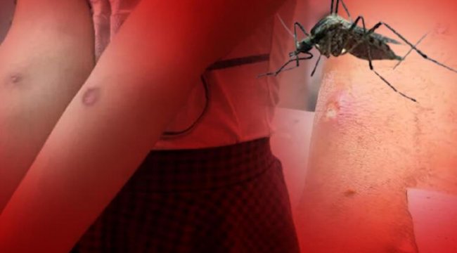 Sivrisinek tehlikesi! 3 ölümcül hastalık riski var: Bu belirtilere dikkat