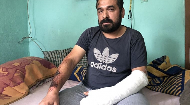 Yaralı madenci: Baret, lamba hiçbir şey kalmamıştı