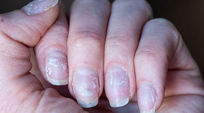 Omicron varyantının yeni belirtisi ortay çıktı!