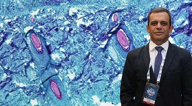 Maymun çiçeği virüsü pandemiye dönüşür mü?