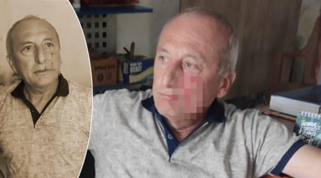 Yarbaşı Belediye Başkanı Mustafa Kaynar'a dayısından yumruklu saldırı