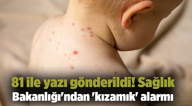 81 ile yazı gönderildi! Sağlık Bakanlığı'ndan 'kızamık' alarmı