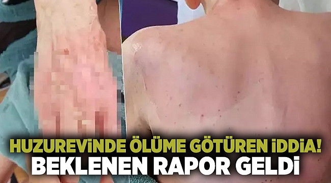 Huzurevinde ölüme götüren iddia! Beklenen rapor geldi