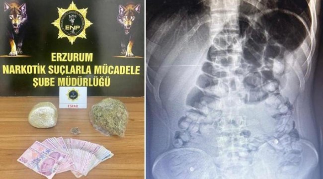 Erzurum&#039;da yolcu otobüsüne denetim! Yolcunun midesinden afyon sakızı çıktı