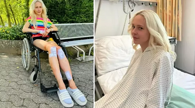 Model, sevgilisinin "Daha uzun olmadıkça seni sevmem" demesi üzerine 167 bin dolar harcayarak boy uzatma ameliyatı oldu