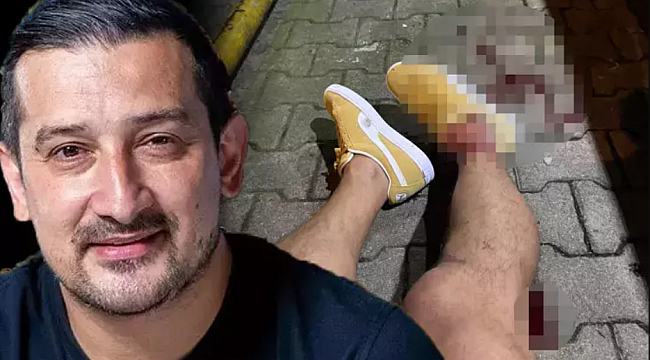 Serhat Akın&#039;a silahlı saldırıda 2 kişi yakalandı, 2 kişi aranıyor