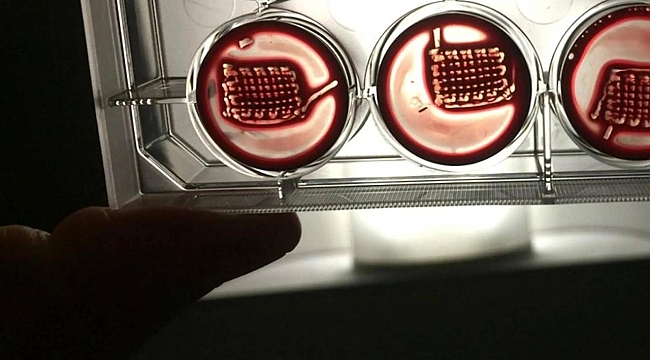 "Hastaların kanıyla kırık kemikleri tedavi edecek" implant geliştirildi