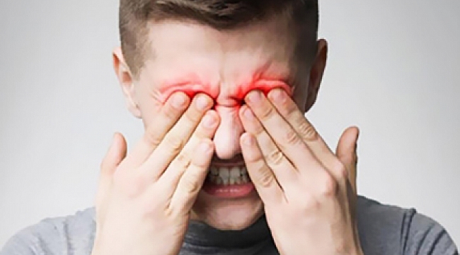 Göz Yanması Neden Olur? Nelere Dikkat Edilmeli? Nasıl Tedavi Edilir?