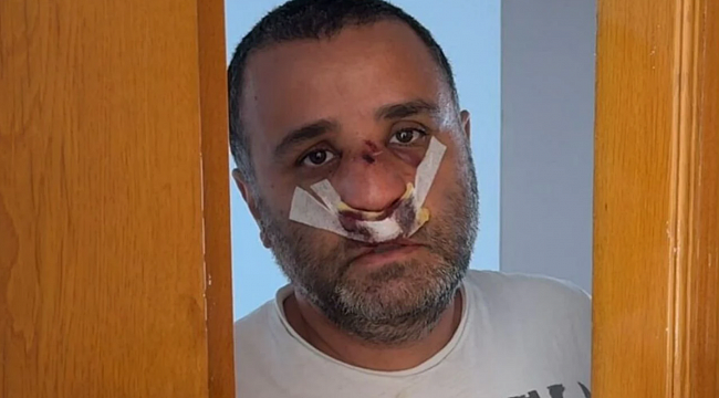 Marmaray’da darp edilen baba sessizliğini bozdu