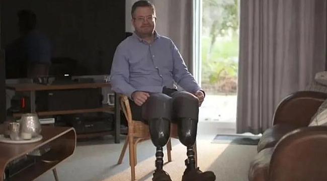 Kendi bacaklarını kesen cerrah dolandırıcılıktan hapse atıldı