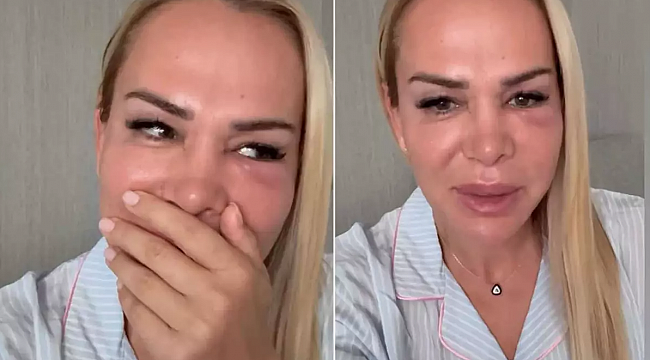 Nagihan Karadere&#039;den &quot;darp edildi&quot; iddialarına sert tepki