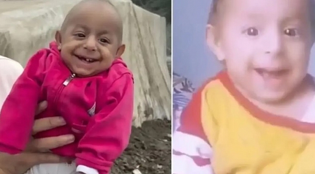 Ökkeş Bebek (gülen bebek) neden öldü?