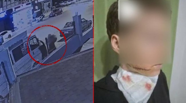 Alanya’da sokak ortasında dehşet! Yolda yürüyen kadına saldırıp yüzünü kesti