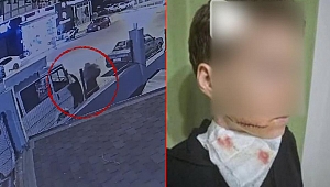 Alanya’da sokak ortasında dehşet! Yolda yürüyen kadına saldırıp yüzünü kesti