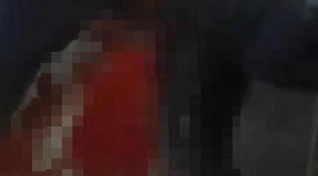 Üsküdar’da bıçaklı kavga: 1 yaralı