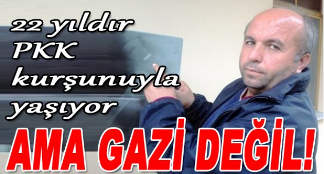 22 Yıldır PKK Kurşunuyla Yaşıyor