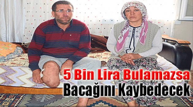 5 Bin Lira Bulamazsa Bacağını Kaybedecek