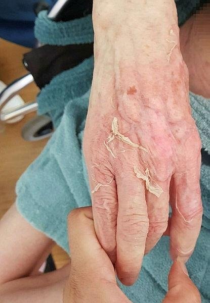 Huzurevinde ölüme götüren iddia! Beklenen rapor geldi