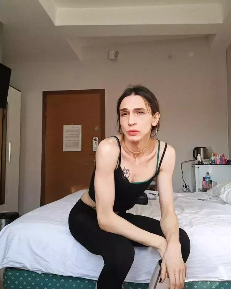 Cinsiyet değiştiren oyuncu Ahmet Melih Yılmaz son halini yayınladı