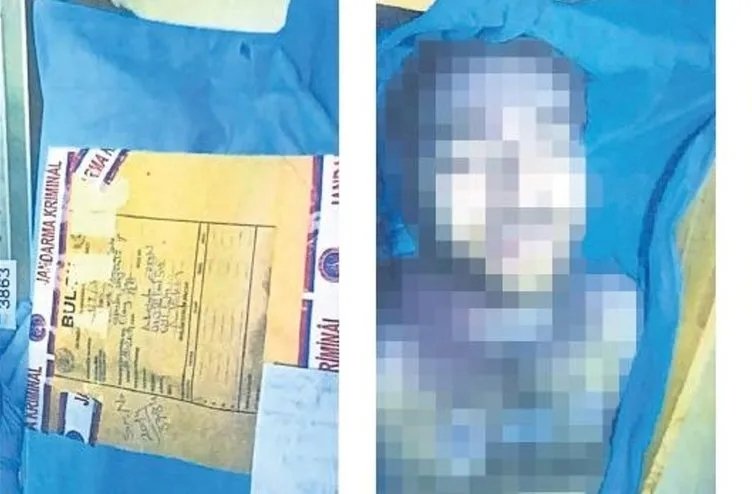 Cem Garipoğlu'nun otopsi fotoğrafları ortaya çıktı