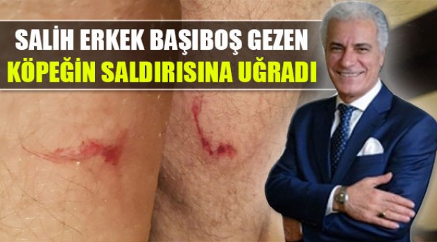 Başıboş Köpek Salih Erkek'i Isırdı