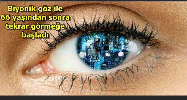 Biyonik göz ile 66 yaşında tekrar görmeye başladı