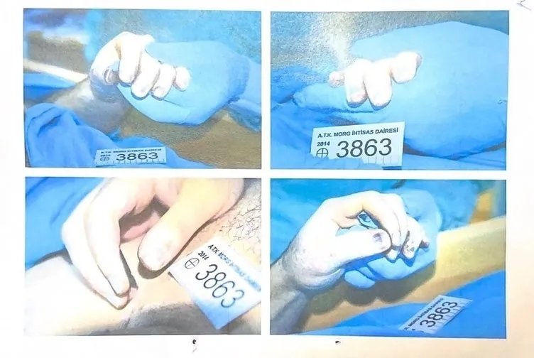 Cem Garipoğlu'nun otopsi fotoğrafları ortaya çıktı