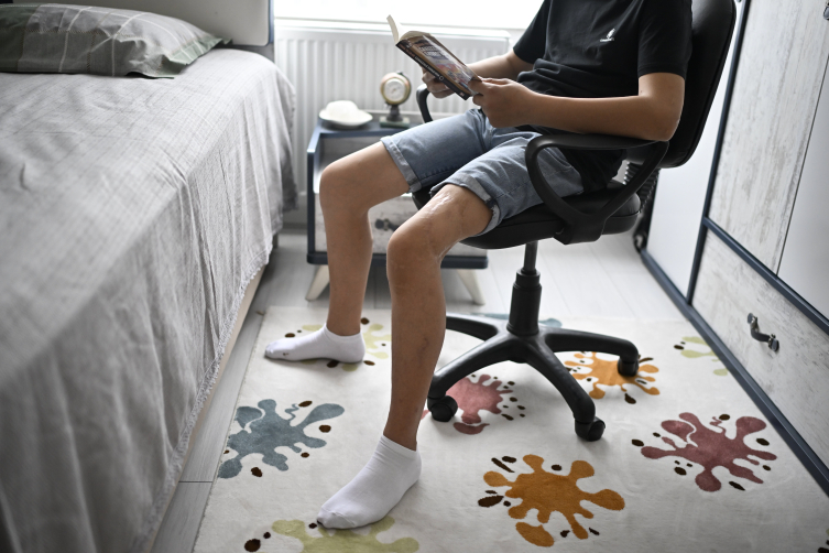 Başıboş köpeklerin saldırısı sonucu 20 ameliyat geçirdi