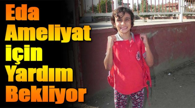 Eda Ameliyat için yardım bekliyor