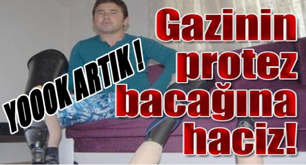 İzmirli gazinin protez bacağına haciz!