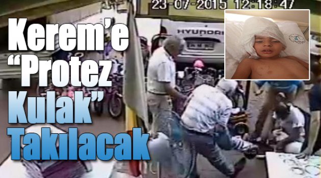 Kerem'e Protez Kulak Takılacak