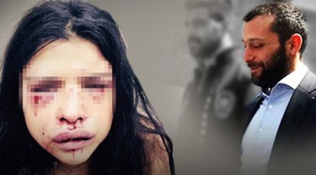 Onur Özbizerdik serbest kaldığı gün kız arkadaşını hastanelik etti